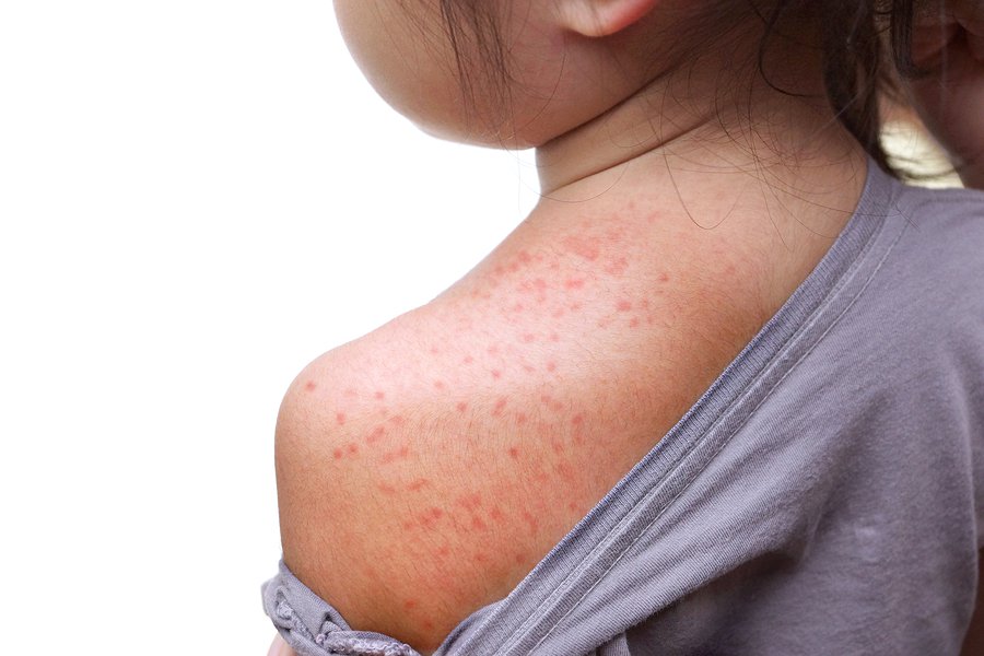 ABC: New York county just banned unvaccinated kids from all public places