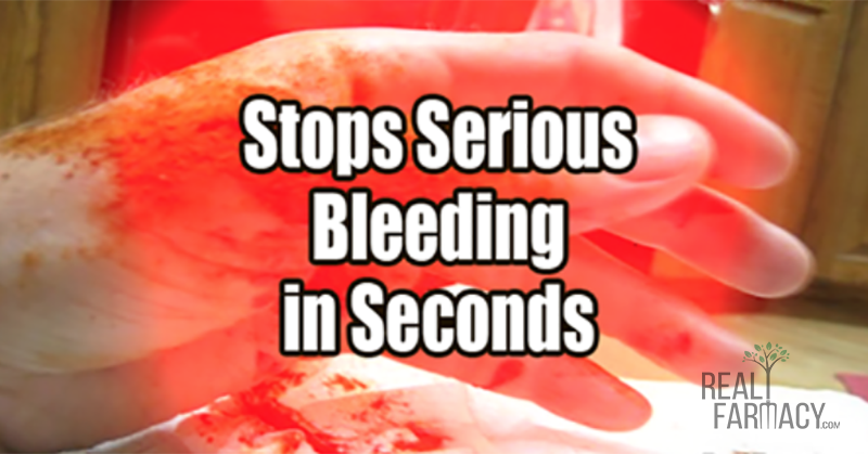 The Best First Aid Herb: How to Stop Serious Bleeding in 10 Seconds