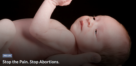 StemExpress Harvested Hearts and Heads From LIVE Babies for Profit | True Conservative Pundit