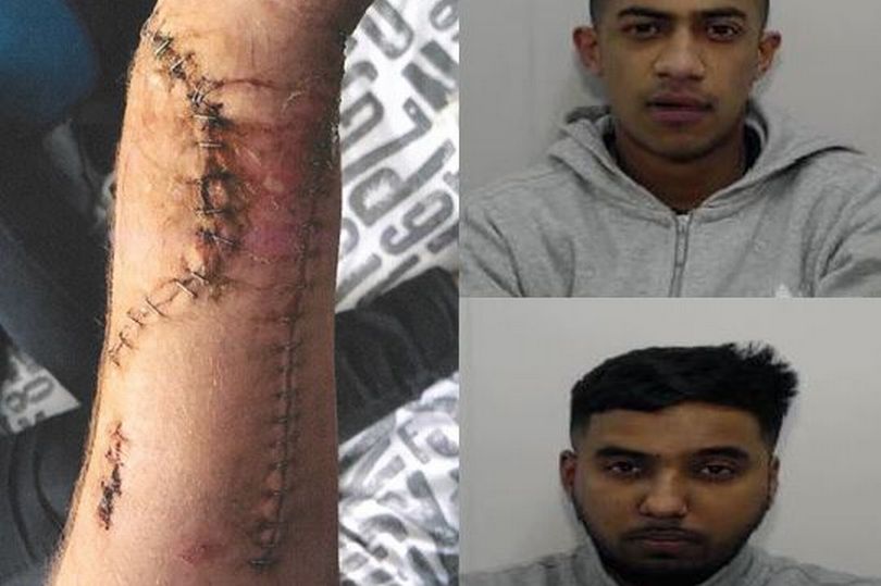 UK: Racist migrant gang cut teen worker’s hand off in targeted attack on ‘white bastards’ - Voice of Europe