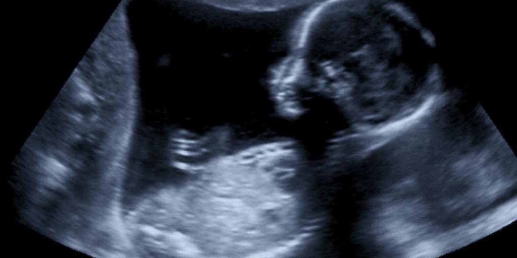 Supreme Court rejects ACLU challenge to Kentucky ultrasound law | News | LifeSite