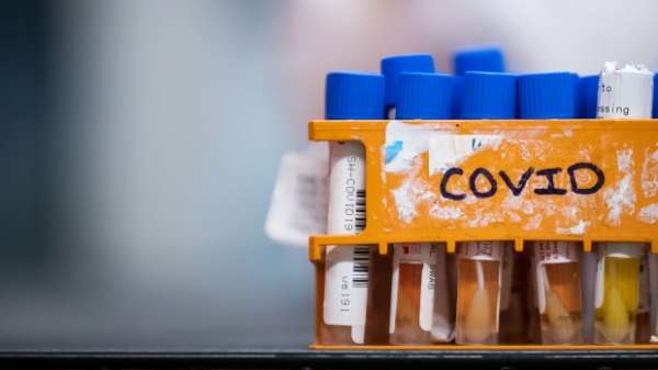 First Canadian clinical trial for potential COVID-19 vaccine approved | CTV News