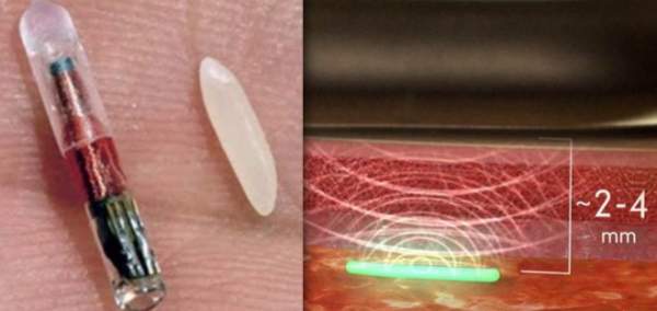 DARPA-Funded Implantable Biochip to Detect COVID-19 Could Hit Markets by 2021 » Sons of Liberty Media