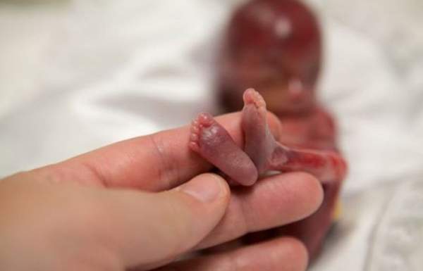 Miscarried at 19 weeks, baby Walter's life is changing the abortion debate