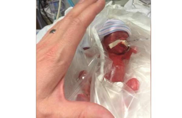 Doctors Said Little Naomi Was So Premature There Was No Hope for Her, But Her Parents Prayed  |  LifeNews.com