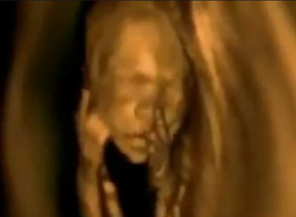 Incredible Video Shows Unborn Babies Jumping Around, Waving, Yawning and Sucking Their Thumb  |  LifeNews.com