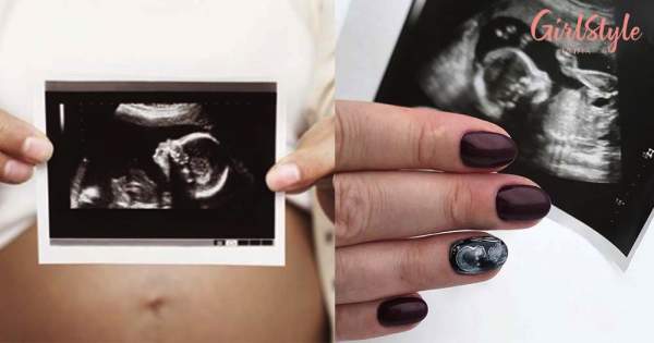 Ultrasound Nail Art Ideas For Moms-To-Be | GirlStyle India