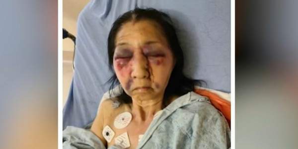 70-year-old Mexican-American grandmother brutally beaten on bus by attacker who thought she was Asian - TheBlaze