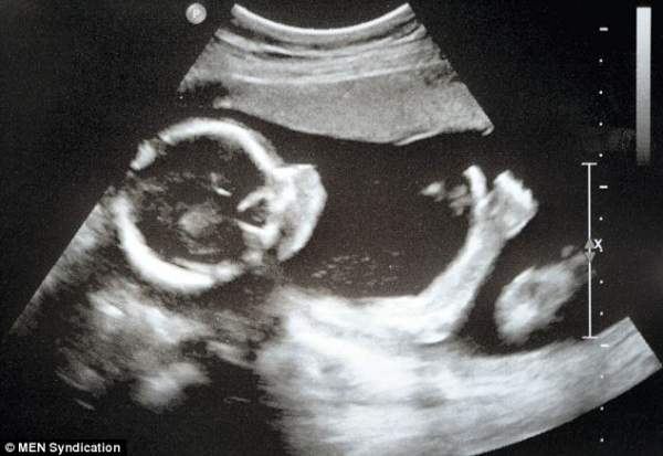 Kentucky Legislature Passes Amendment Saying There’s No Right to Kill Babies in Abortions  |  LifeNews.com