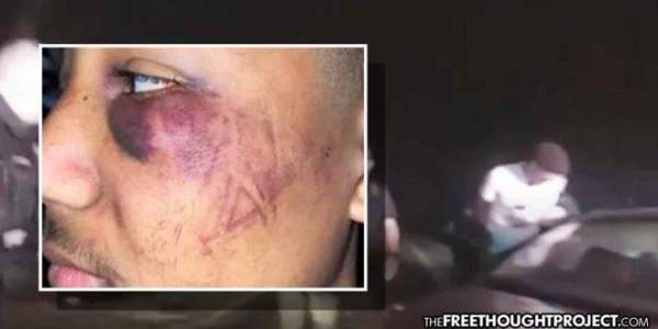 California: Cops Arrested After Beating Teen so Violently, They Left Boot Marks On His Face - For A Speeding Ticket (Video) - The Washington Standard