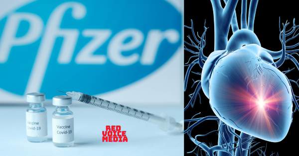 Healthy 27-Year-Old Woman's Heart Damaged By Pfizer Jab; "Heart Of An 80-Year-Old" Says Doctor