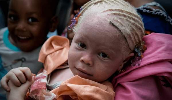 Familienvater in Mosambik verhaftet, als er seine drei Albino-Kinder für 38.000 € verkaufen wollte, damit sie später in Malawi für Hexerei eingesetzt werden können – Jihad Watch Deutschland
