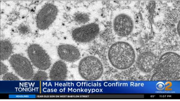 EXPERTS: Monkeypox Spread by Gay Sex Between Men... So How Did Those Children, Dogs and 2-Yr-Old Get Monkeypox?