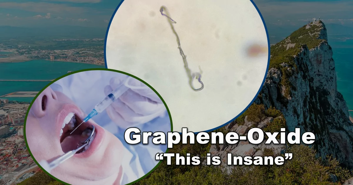 Suspected presence of graphene-oxide in dental anesthetic found in Gibraltar - Gibraltar Messenger