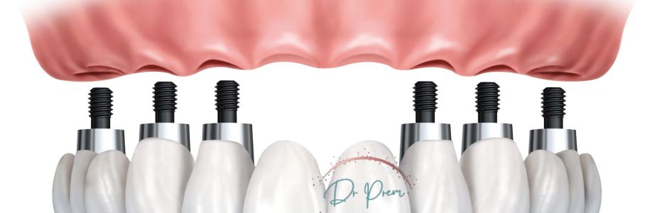 Tooth Implants to Dental Bridges Cover Image