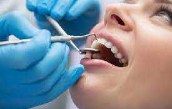 Affordable Root Canal Melbourne