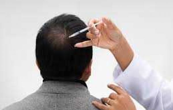 Understanding GFC Hair Treatment