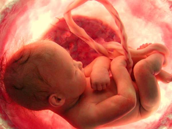 NEIN zur Legalisierung der Abtreibung – Menschenwürde verteidigen! – PatriotPetition.org