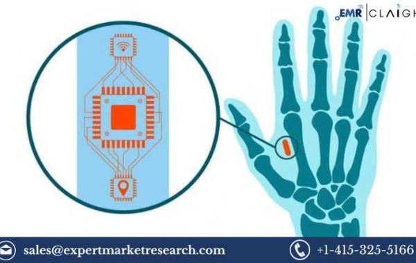 Biochip Market Size, Share, Trends, Growth, Analysis, Report and Forecast 2024-2032