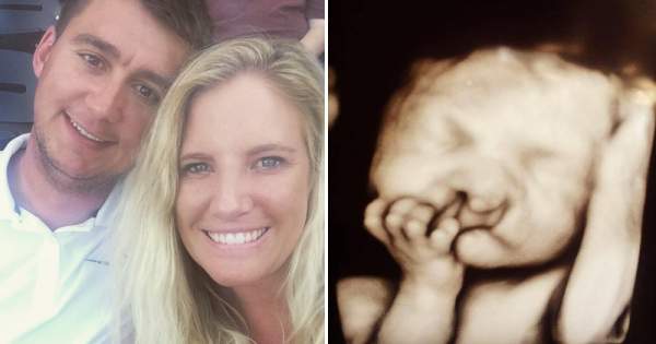 Parents Refuse To Abort ‘Deformed’ Baby — Look At Him 2 Years Later - THE TRUTH